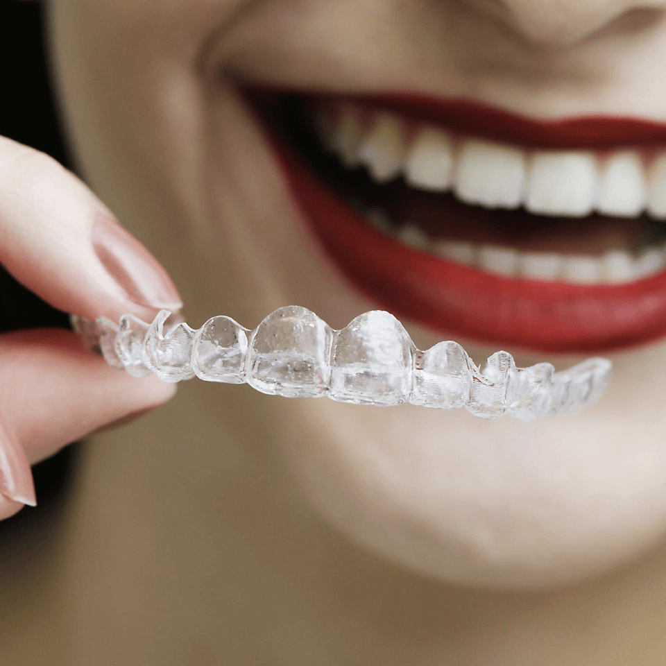 invisalign em fortaleza